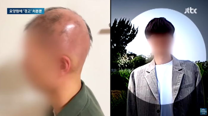 “탈모에 코털까지 다 빠졌다”...23살 사회복무요원이 요양원에서 당한 일들