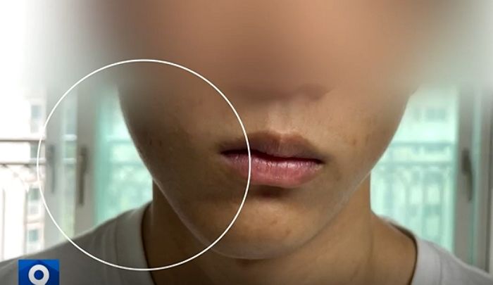 8분 지각했다고 ‘고3 학생’ 뺨 때려 전치 2주 상해 입힌 담임교사...분리조치 없어