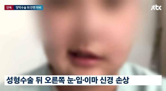 실명 사고 냈던 강남 유명 성형외과...이번엔 20대 여성 ‘안면 마비’ 호소