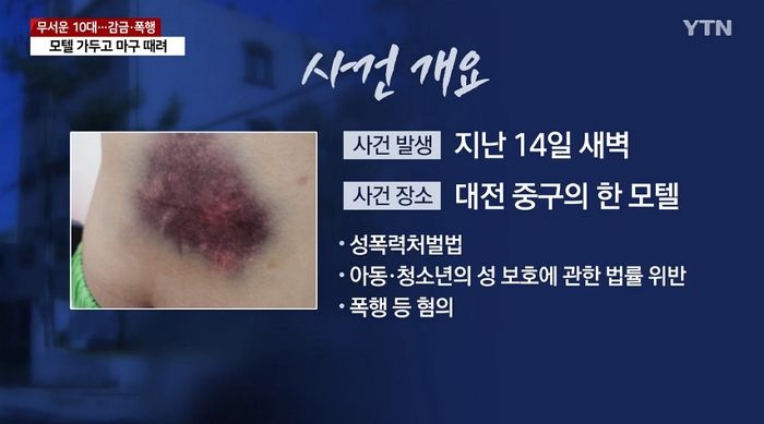 “임신 못 하게 만들겠다”며 여고생 배 집중 폭행한 10대들
