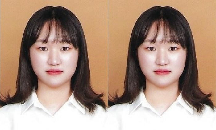 23살의 제빵사를 꿈꾸던 정희수씨, 장기기증으로 6명에게 새 삶 선물하고 세상 떠나