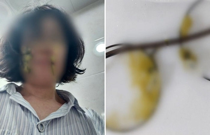 어린이집 교사 얼굴에 ‘똥 기저귀’ 던진 학부모, 선처 없이 ‘재판’ 넘겨져