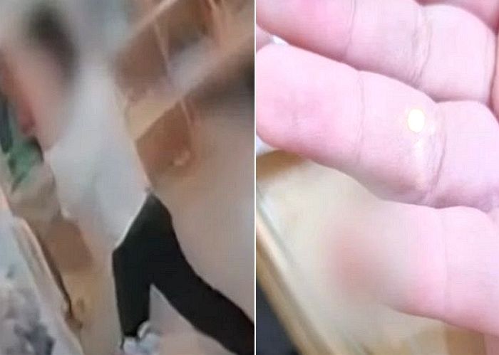 교사가 ‘쾅’ 닫은 문에 손가락 절단된 4살 아이...유치원 CCTV는 모두 삭제됐다 (영상)