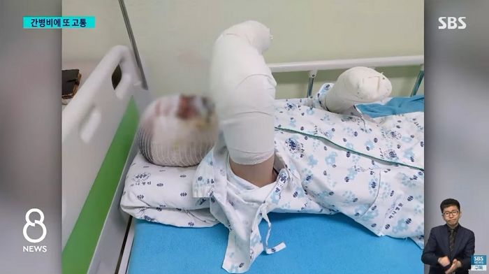 화재 진압 중 온몸에 ‘화상’ 당했는데, 간병비 쥐꼬리만큼 받고 있는 소방관들 상황