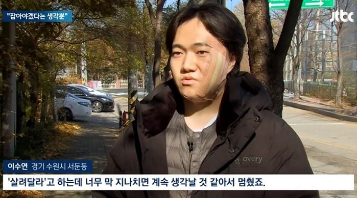 여성 ‘묻지마 폭행’하는 괴한 말리다 칼맞고 50바늘 꿰맨 남성...“피해자 무사해 다행”
