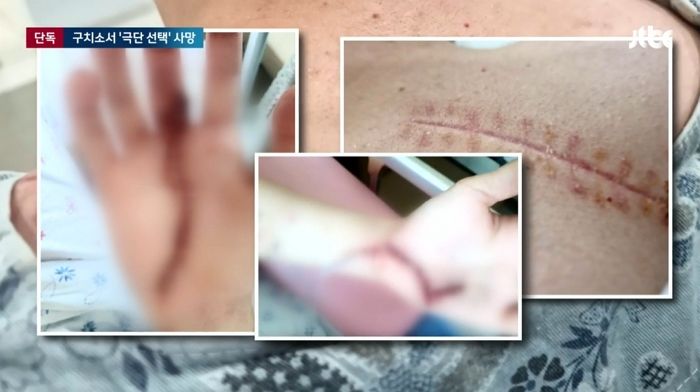 전 여친 두고 싸우다 현 남친에게 ‘영구 장애’ 입힌 20대 남성,  구치소서 극단 선택