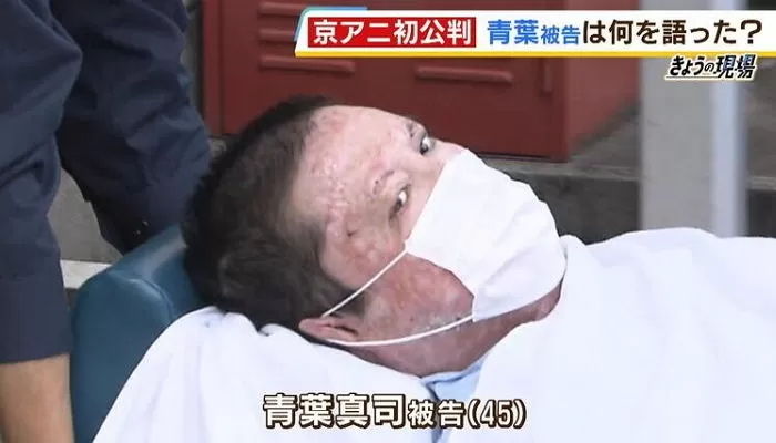 사망 확률 97.45% 였던 방화범 쪽잠자며 살려내 ‘사형’ 구형 받게 한 의사
