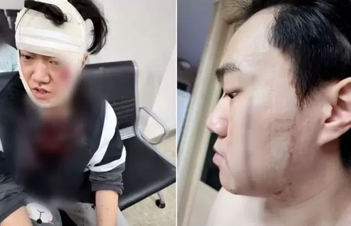 인사이트