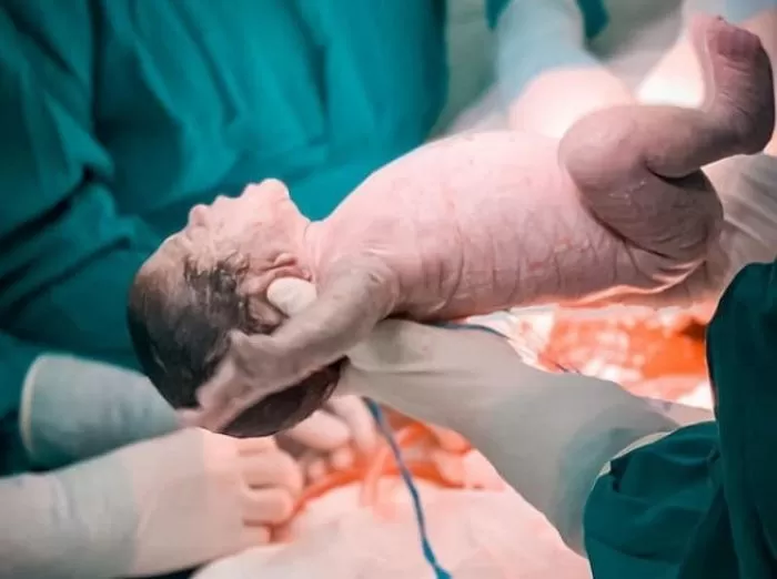 기사의 이해를 돕기 위한 자료 사진 / Tu Du Hospital