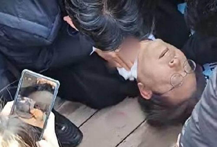 민주당 “목숨 잃을뻔 했는데 아무도 ‘이재명 대표님 괜찮으시냐’ 묻는 언론 없어 씁쓸”
