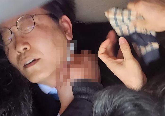 “이재명, 나무젓가락에 찔렸다”는 말 나오자...경찰, 직접 ‘흉기 정체’ 싹 밝혔다