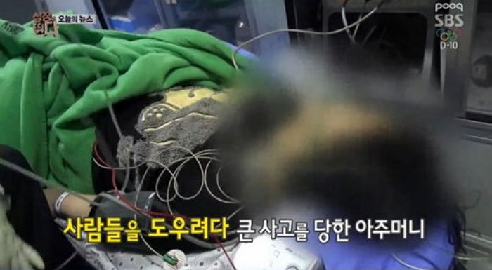 눈길 교통사고 난 뒤 시민들 도우려다 다리 다친 아주머니...‘길막’ 차량들 때문에 결국 절단