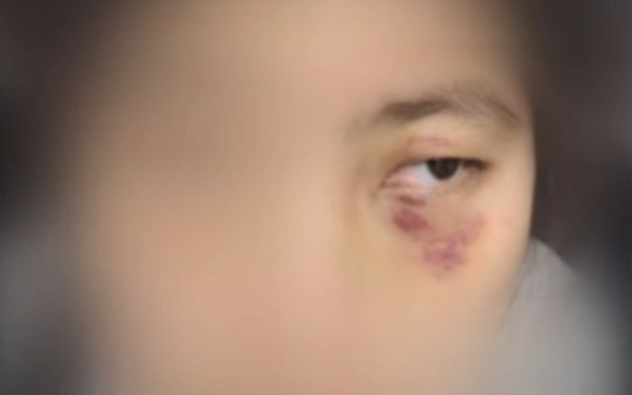 청각장애인 커플 감금하고 멍 들 때까지 폭행·갈취한 남성들...알고 보니 가해자도 청각장애인