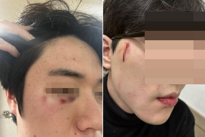 “길 안 비켜줬다고 시비 걸더니 지인 30명 데리고 와 일가족을 집단폭행 했습니다”