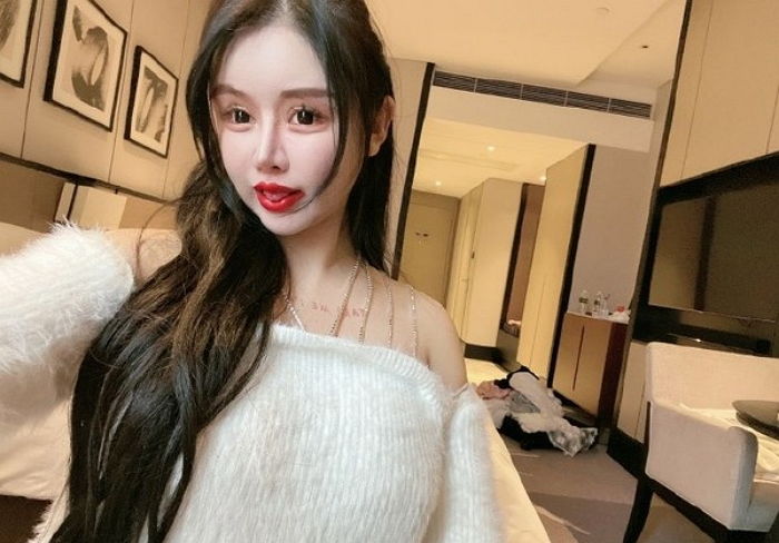 ‘쌍수’하고 친구들이 잘해주자 더 예뻐지겠다며 성형수술 100번 한 19살 소녀