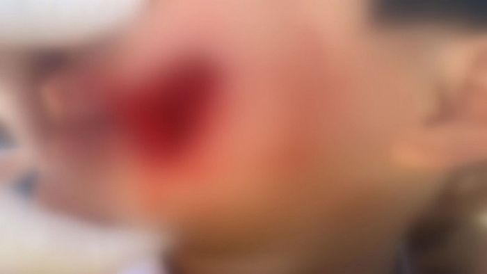 제주 ‘승마 체험장’서 7살 아이가 말에 얼굴 물어 뜯기는 충격적인 사고 발생