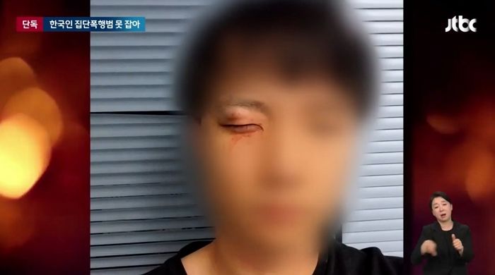 호주 워홀 갔다가 눈 작다는 이유로 경찰서 앞에서 ‘집단 폭행’ 당한 20대 한국인 남성