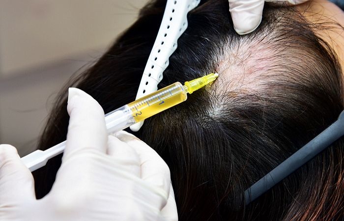 “수백만원 들여 모발이식했는데 의사 대신 ‘간호조무사’가 수술했습니다”