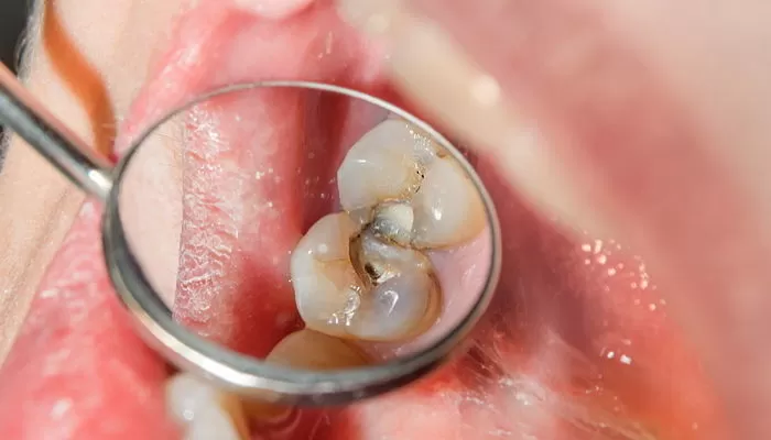 기사의 이해를 돕기 위한 자료 사진 / gettyimagesBank