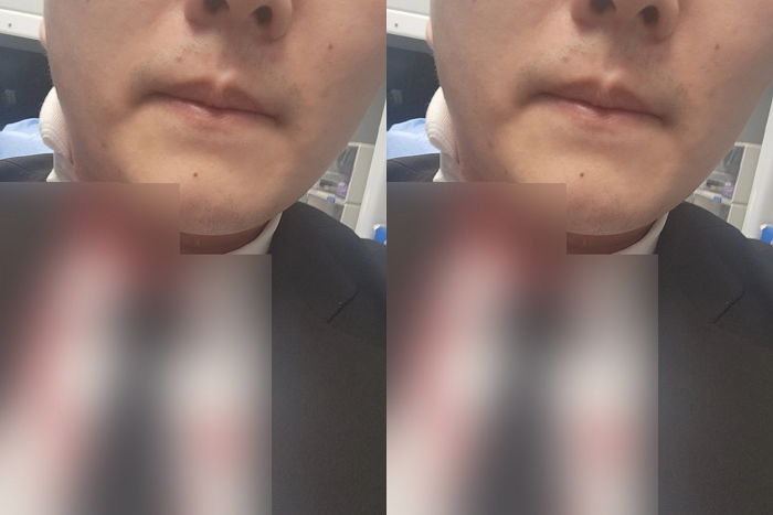 “조용히 해달라” 한마디에 PC방서 묻지마 칼부림 당한 남성
