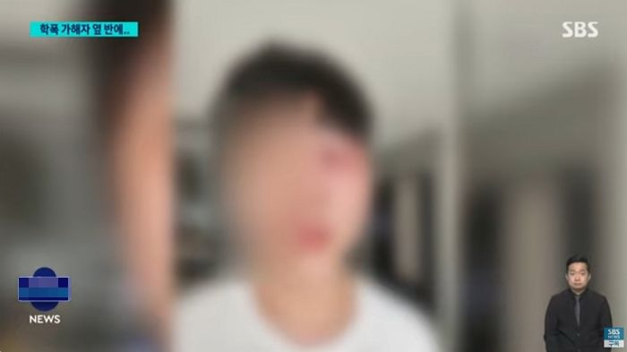 같은반 친구 학폭으로 ‘실명위기’까지 오게한 중1 가해학생...학교 조치는 ‘옆 반으로 이동’