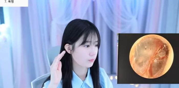 인사이트