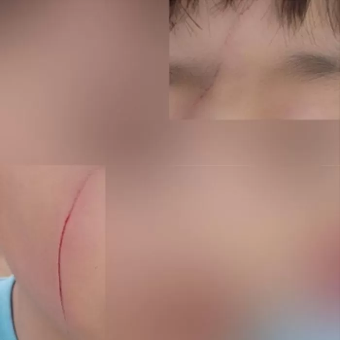 인사이트