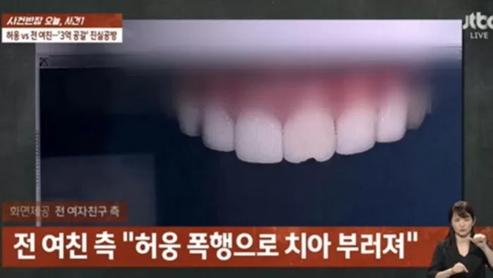 인사이트