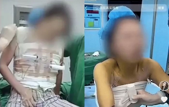 5개월 전 가슴 확대 수술한 여성의 호소...“제 수술 영상이 온라인에 돌아다니고 있습니다”