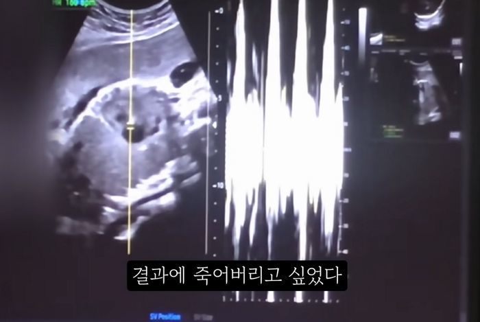 경찰, ‘36주 낙태 영상’ 유튜브 압수수색 ... “게시자 특정 중”