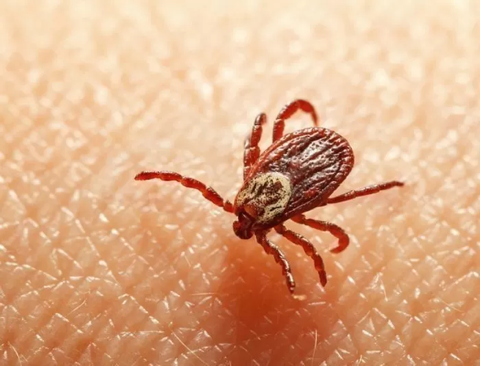 “It became thinner and then all of it fell out”… Woman in her 20s suffered hair loss after being bitten on the scalp by a tick.