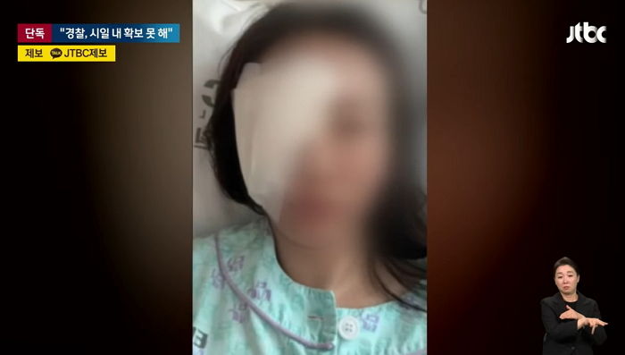 “홍대 클럽서 백인 여성에게 ‘묻지마 폭행’ 당해 눈 뼈 부러졌습니다” (영상)