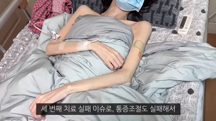 연명치료 포기 후 ‘호스피스 병동’ 들어간 20대 말기암 유튜버 ‘유병장수걸’... 2개월 만에 전해진 근황