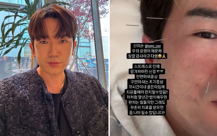 ‘26억 사기’ 피해 당한 이민우 근황... 스트레스로 안면신경마비까지