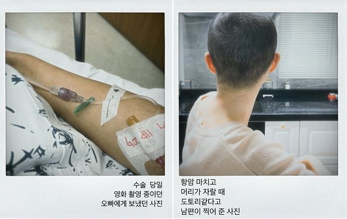 암 투병하느라 삭발한 이솔이에게 ‘사랑꾼’ 박성광이 보인 러블리한 반응