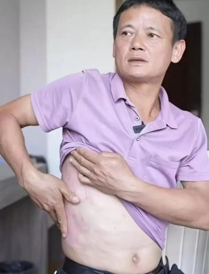 인사이트