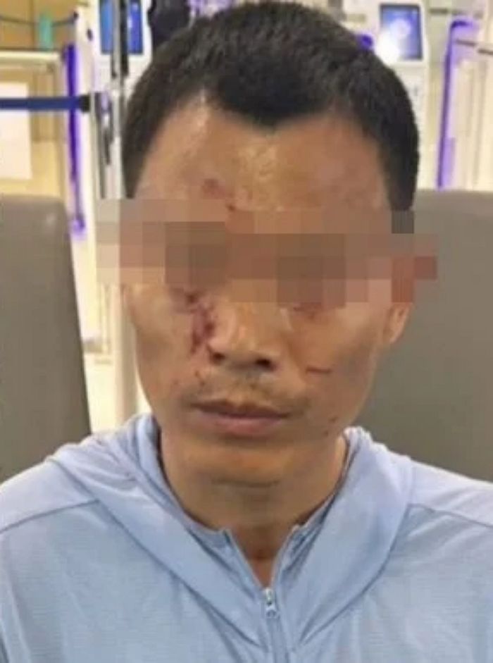 유명 관광지서 장기 일부 사라진 여성 시신 발견돼... 중국인 관광객 체포