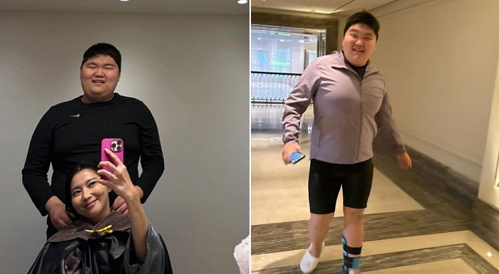 오윤아, ‘발달장애 아들’ 안타까운 부상... 근황 공개