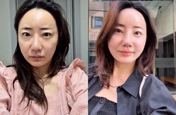 ‘조혜련 올케’ 박혜민, 코 성형 이후 “나도 코버지 있다” 만족감 드러내