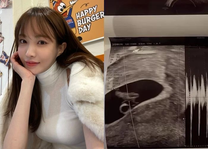 서민재 “임신 9주차... 남친 연락두절, 아버지로서 책임 다하길”