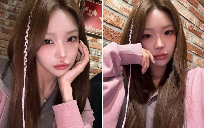 “저 내일 수술하러 가요”... 최준희 SNS에 근황 알렸다