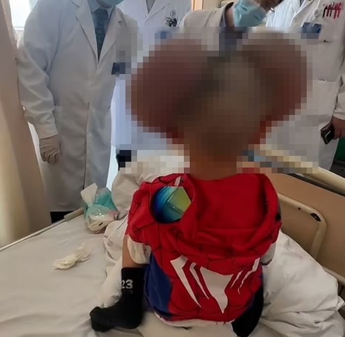 ‘미키마우스’라 불린 3살 소년, 의료진 도움 끝에 평범해졌다... 놀라운 변화 공개