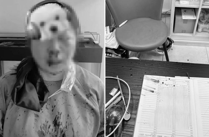 스케일링 받다가 이빨 시리다며 여의사 얼굴에 주먹 내리꽂은 20대 환자... 진료실은 피투성이