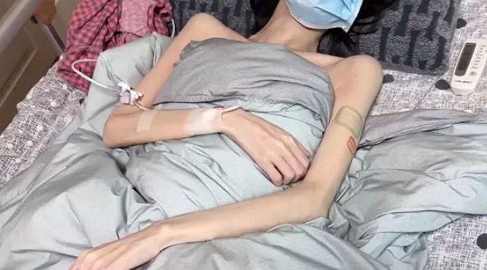 의사 선생님이 작별 인사를... 20대 여성 희귀암 말기 유튜버 ‘유병장수girl’ 근황