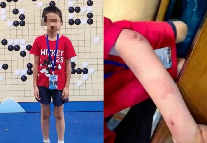 9살에 세상 떠난 ‘바둑 신동’... “경기 지면 아빠가 발로 차고 폭행”