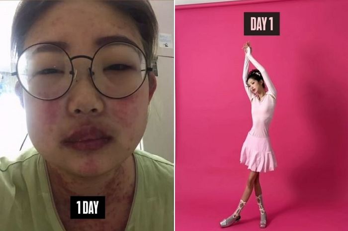 ‘故 최진실 딸’ 최준희, 50kg 감량 후 41kg... “다시 나를 사랑하게 돼”