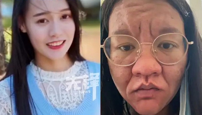 “거울을 보고 깜짝 놀랐어요”... 출산 전후 180도 외모 변한 여성