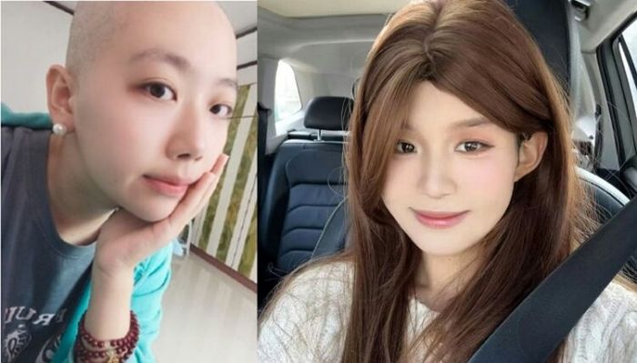 평소 매운 음식 사랑하던 ‘맵덕후’ 인플루언서, 위암으로 사망... 향년 25세