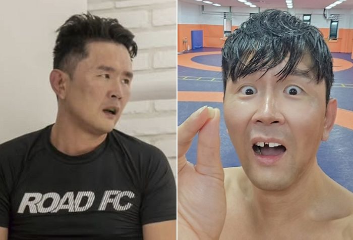 격투기 경기 앞두고 부상당한 윤형빈... “밴쯔와 타격전 준비 중, 이 빠짐 이슈”