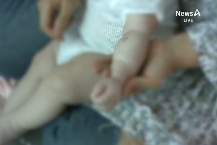 ‘결핵 의심’ 판정에도 산후조리원서 계속 근무한 간호사... 신생아 8명 무더기 ‘결핵’